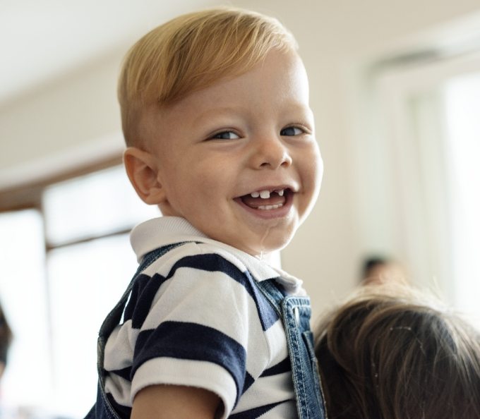 Young boy with a missing tooth smiling after treating lip tie in Southampton