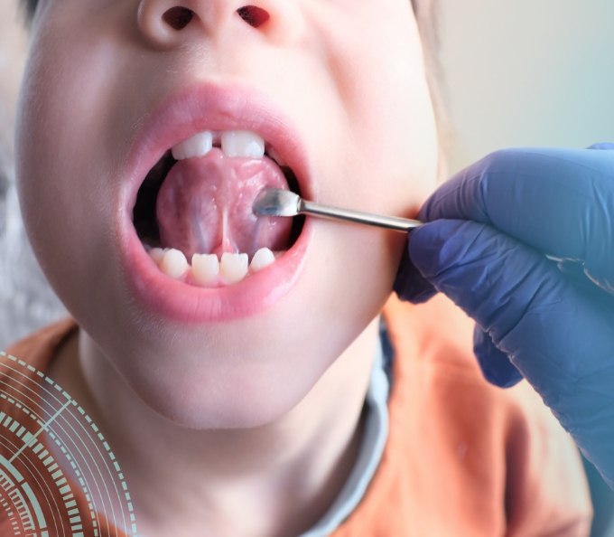 Child having their mouth examined for tongue tie in Southampton